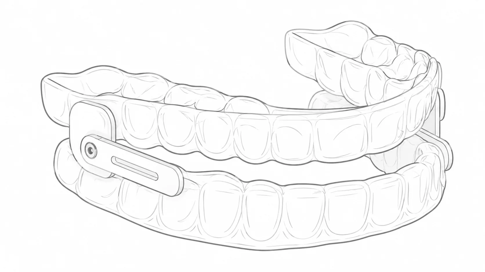 Mandibular Advancement Device